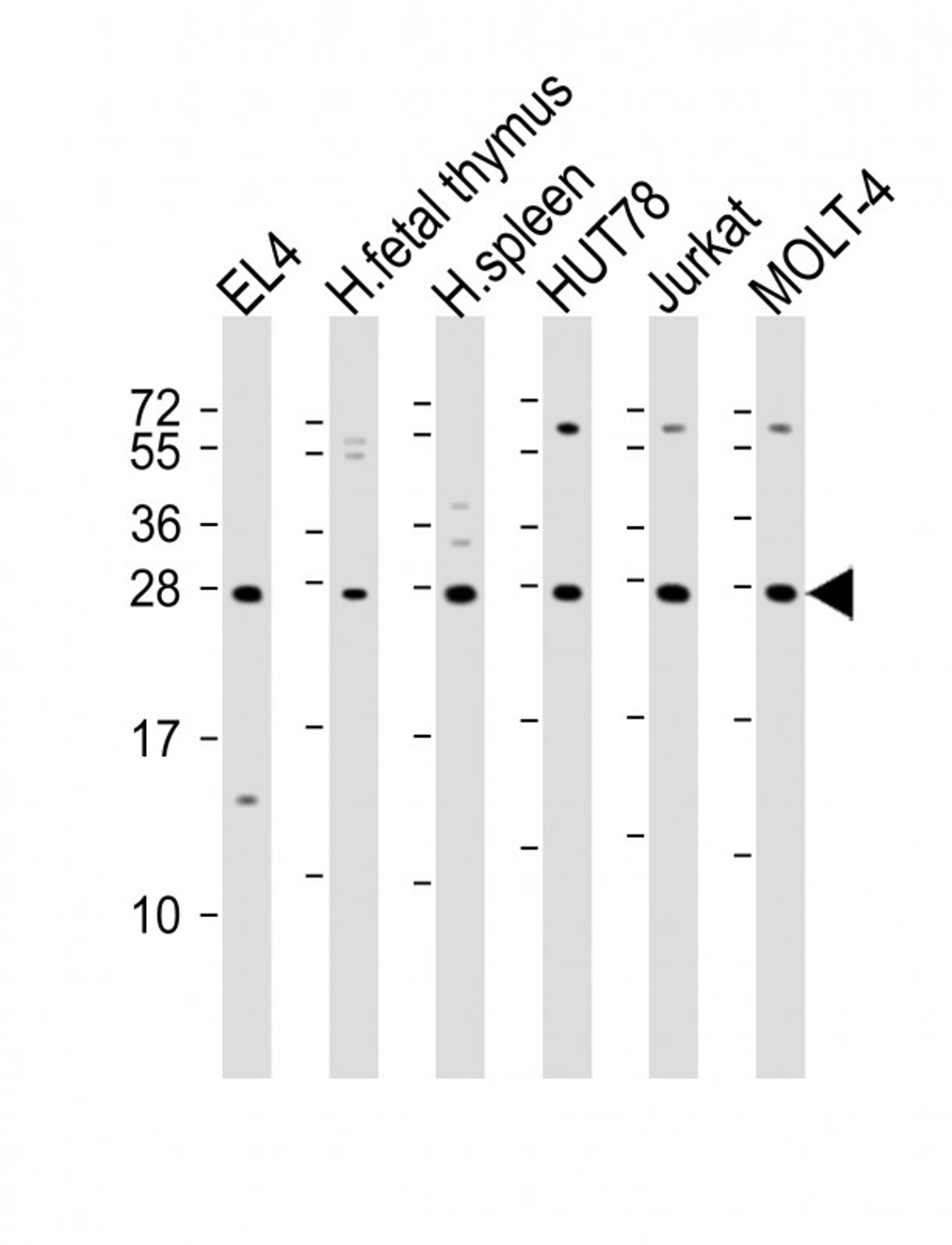 Western Blot at 1:2000 dilution Lane 1: EL4 whole cell lysate Lane 2: human fetal thymus lysate Lane 3: human spleen lysate Lane 4: HUT78 whole cell lysate Lane 5: Jurkat whole cell lysate Lane 6: MOLT-4 whole cell lysate Lysates/proteins at 20 ug per lan