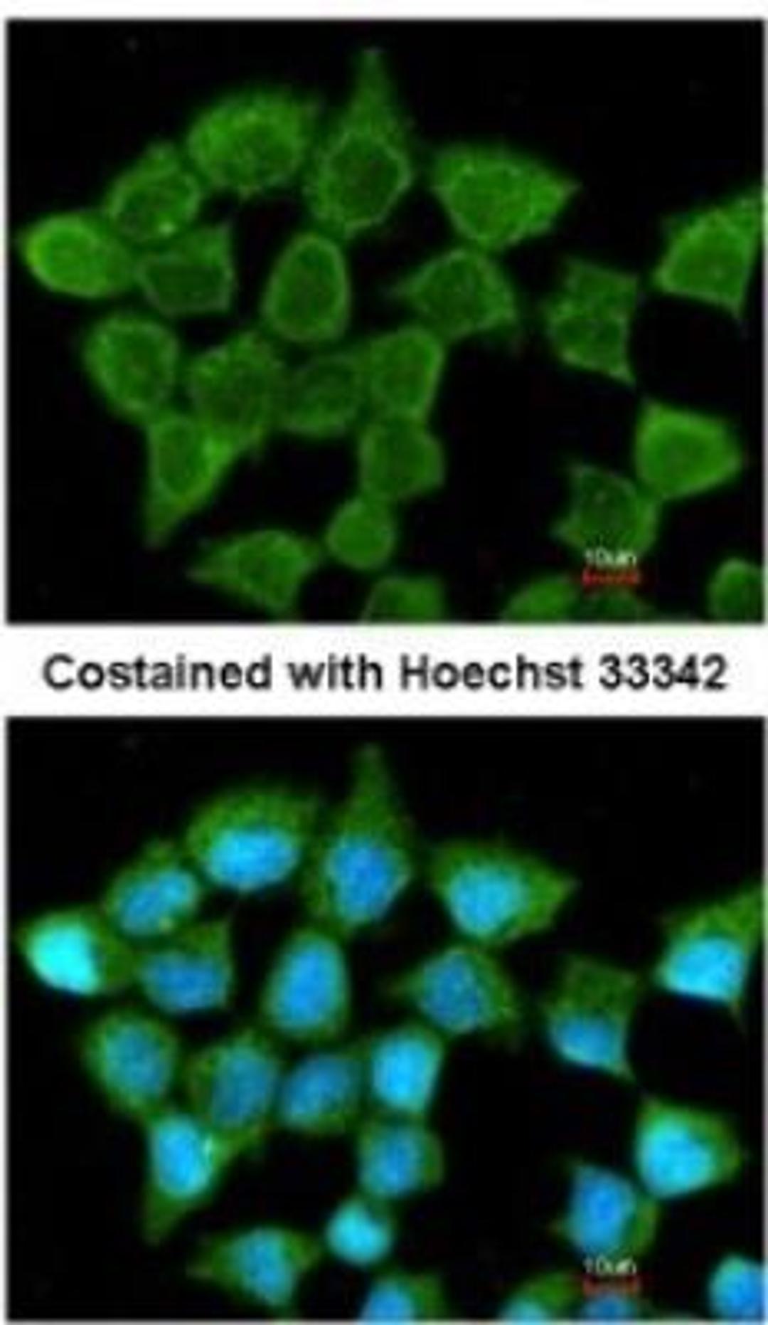 Immunocytochemistry/Immunofluorescence: SUCLA2 Antibody [NBP1-33015] - Analysis of methanol-fixed A431, using antibody at 1:200 dilution.