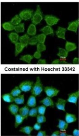 Immunocytochemistry/Immunofluorescence: SUCLA2 Antibody [NBP1-33015] - Analysis of methanol-fixed A431, using antibody at 1:200 dilution.