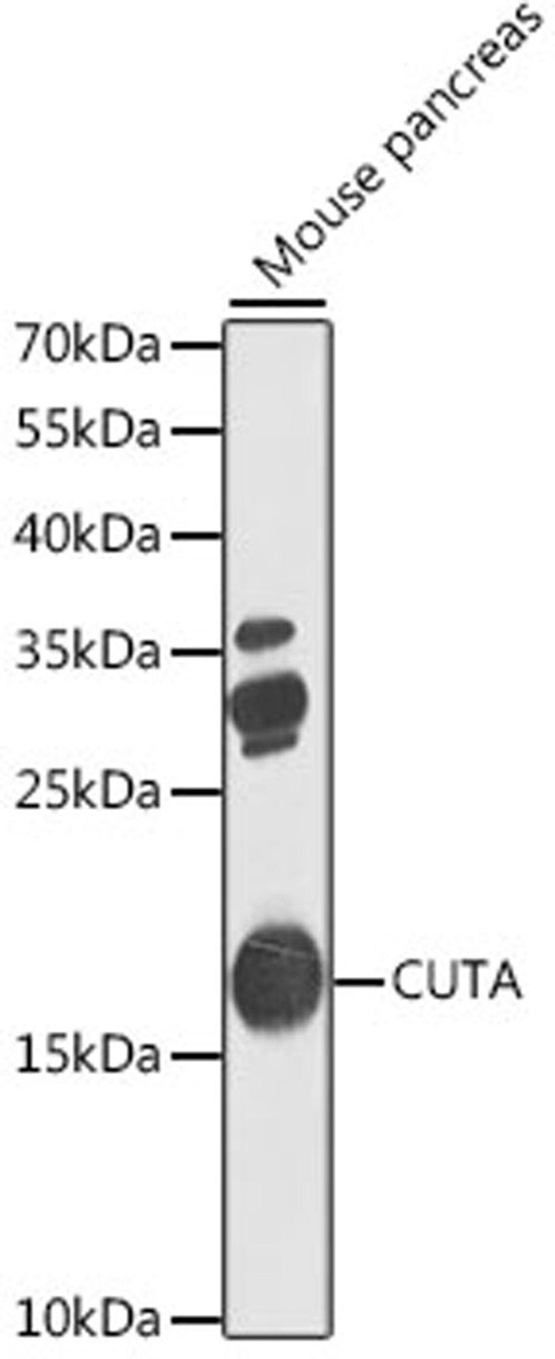 Western blot - CUTA antibody (A7178)