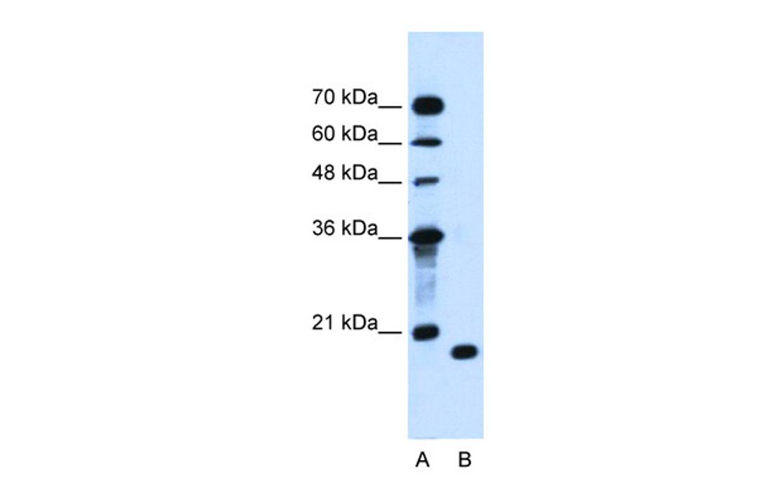 Antibody used in WB on Human Jurkat 1.25 ug/ml.