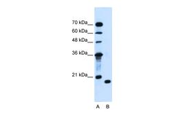 Antibody used in WB on Human Jurkat 1.25 ug/ml.