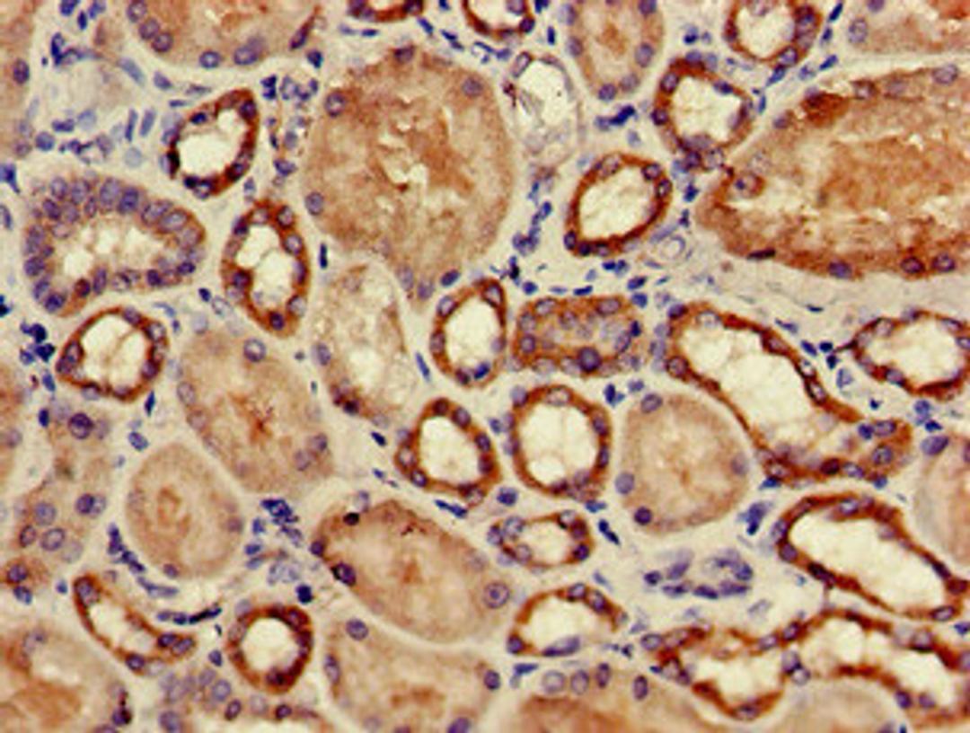 Immunohistochemistry of paraffin-embedded human kidney tissue using CSB-PA03049A0Rb at dilution of 1:100