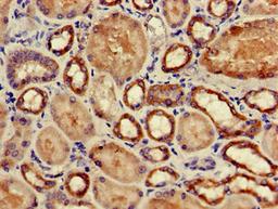 Immunohistochemistry of paraffin-embedded human kidney tissue using CSB-PA03049A0Rb at dilution of 1:100