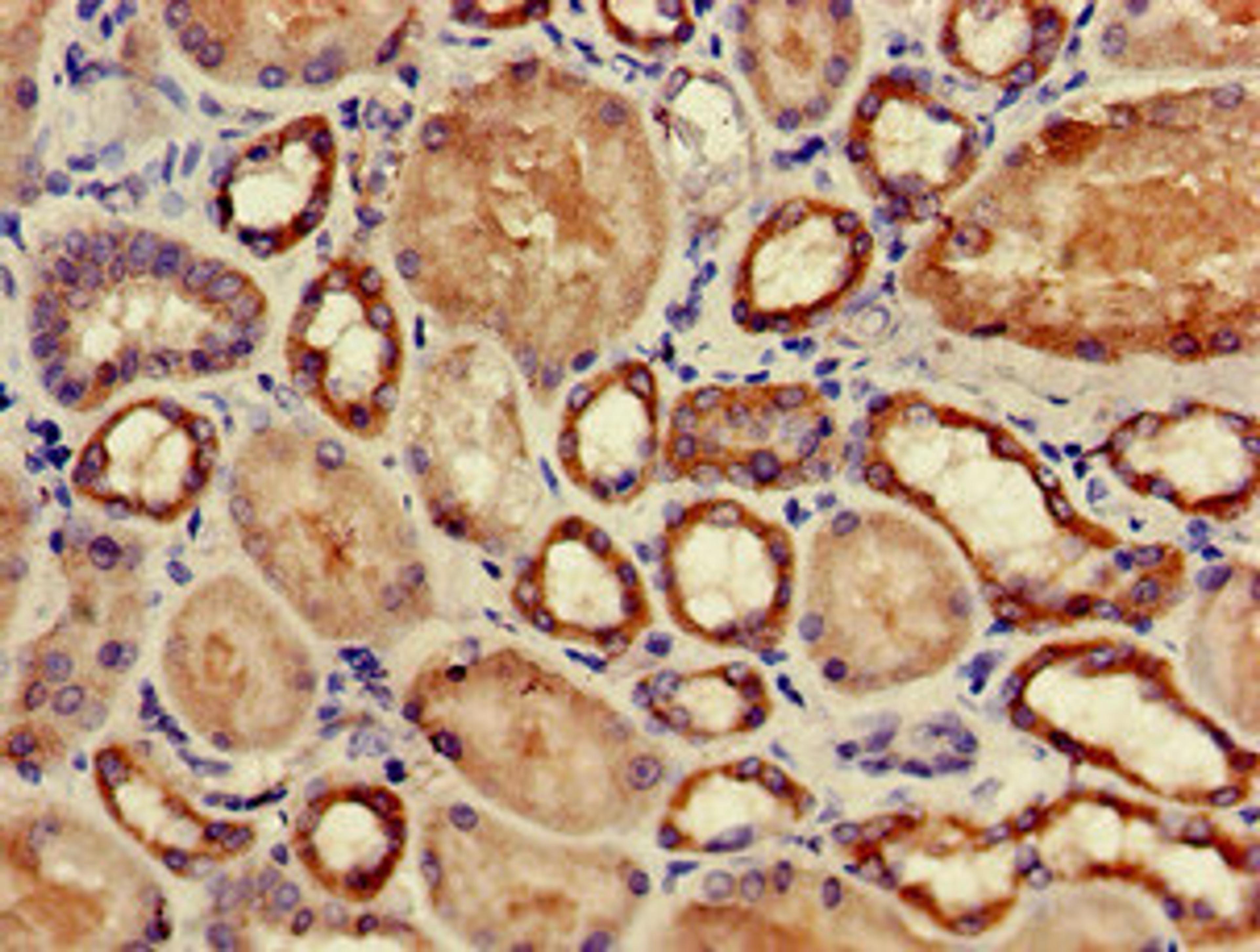 Immunohistochemistry of paraffin-embedded human kidney tissue using CSB-PA03049A0Rb at dilution of 1:100