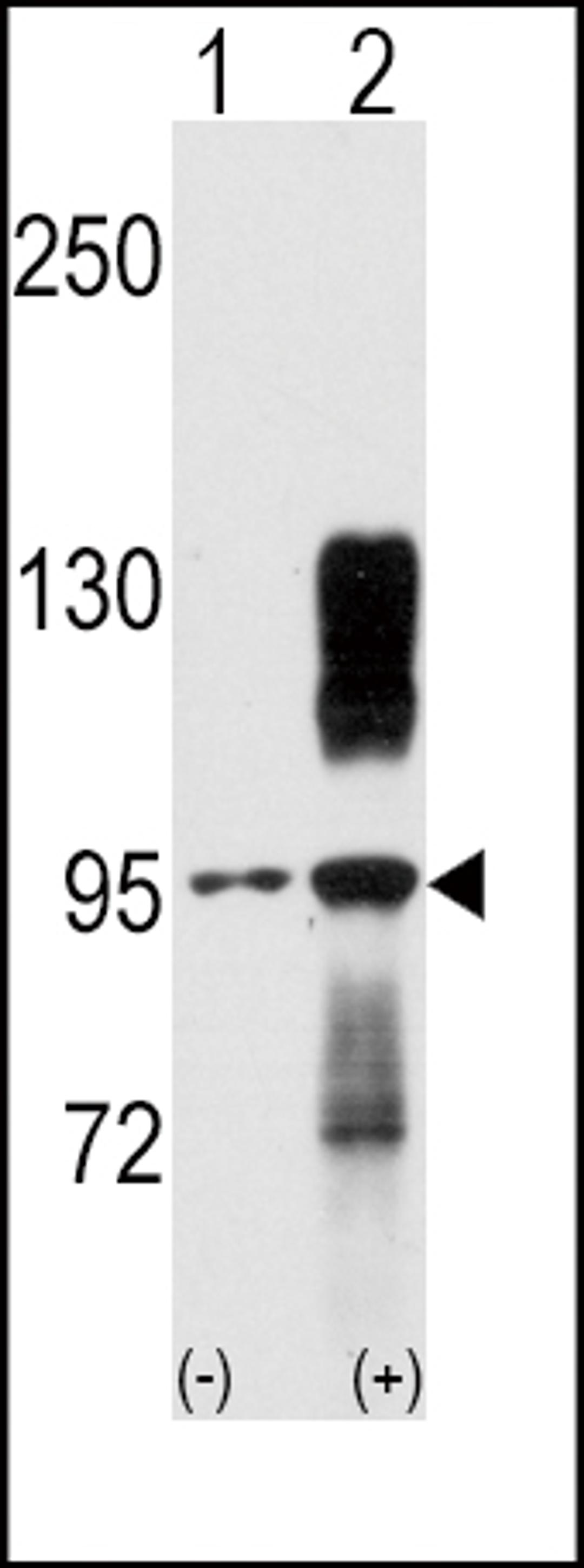 Western blot analysis of TYRO10 using rabbit polyclonal TYRO10 Antibody using 293 cell lysates (2 ug/lane) either nontransfected (Lane 1) or transiently transfected with the DDR2 gene (Lane 2).