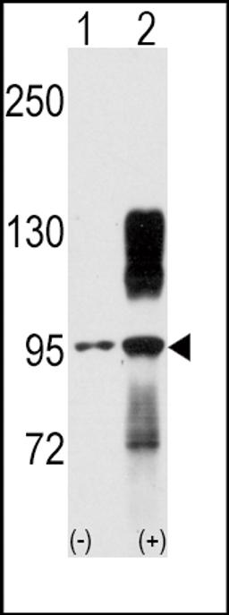 Western blot analysis of TYRO10 using rabbit polyclonal TYRO10 Antibody using 293 cell lysates (2 ug/lane) either nontransfected (Lane 1) or transiently transfected with the DDR2 gene (Lane 2).