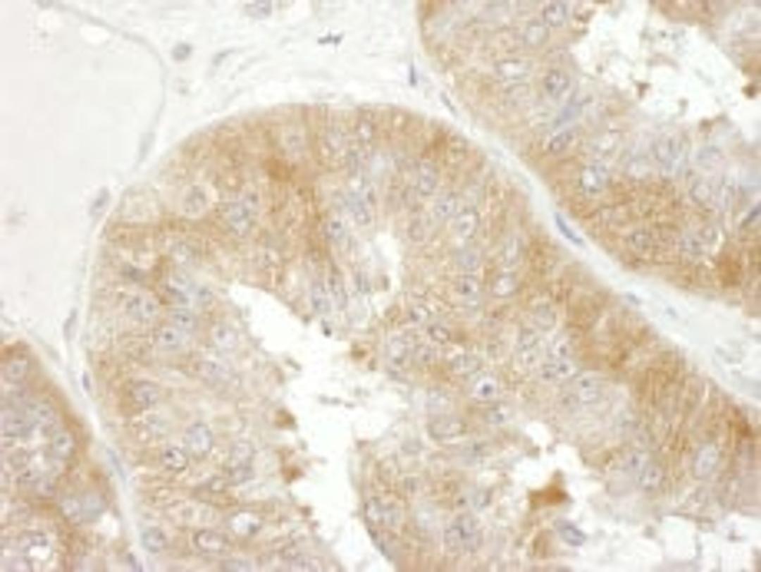 Detection of human eIF3F by immunohistochemistry.