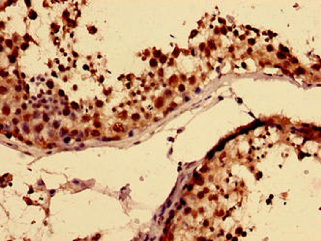 Immunohistochemistry of paraffin-embedded human testis tissue using CSB-PA319143LA01HU at dilution of 1:100