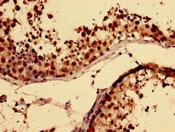 Immunohistochemistry of paraffin-embedded human testis tissue using CSB-PA319143LA01HU at dilution of 1:100