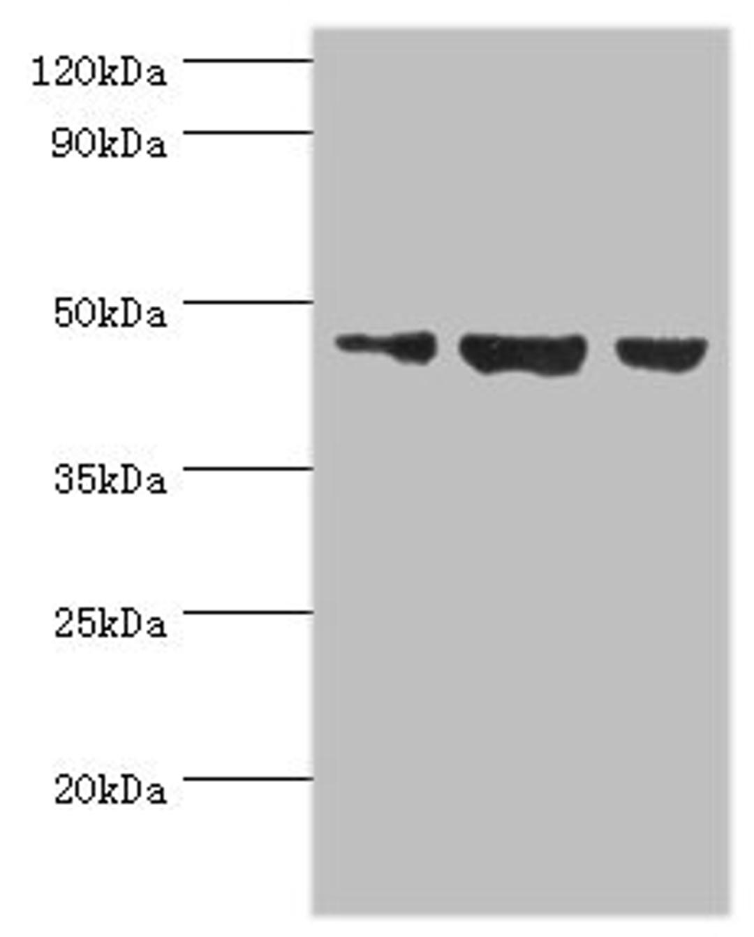Western blot. All lanes: Actin-like protein 6B antibody at 3ug/ml. Lane 1: Hela whole cell lysate. Lane 2: U251 whole cell lysate. Lane 3: HepG2 whole cell lysate. Secondary. Goat polyclonal to rabbit IgG at 1/10000 dilution. Predicted band size: 47 kDa. Observed band size: 47 kDa. 