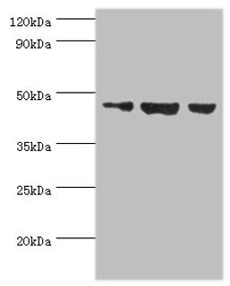 Western blot. All lanes: Actin-like protein 6B antibody at 3ug/ml. Lane 1: Hela whole cell lysate. Lane 2: U251 whole cell lysate. Lane 3: HepG2 whole cell lysate. Secondary. Goat polyclonal to rabbit IgG at 1/10000 dilution. Predicted band size: 47 kDa. Observed band size: 47 kDa. 