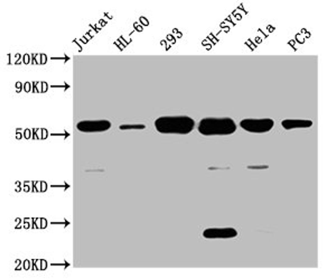 Western Blot. Positive WB detected in: Jurkat whole cell lysate, HL60 whole cell lysate, 293 whole cell lysate, SH-SY5Y whole cell lysate, Hela whole cell lysate, PC-3 whole cell lysate. All lanes: CYP21A2 antibody at 8µg/ml. Secondary. Goat polyclonal to rabbit IgG at 1/50000 dilution. Predicted band size: 56, 53 kDa. Observed band size: 56 kDa