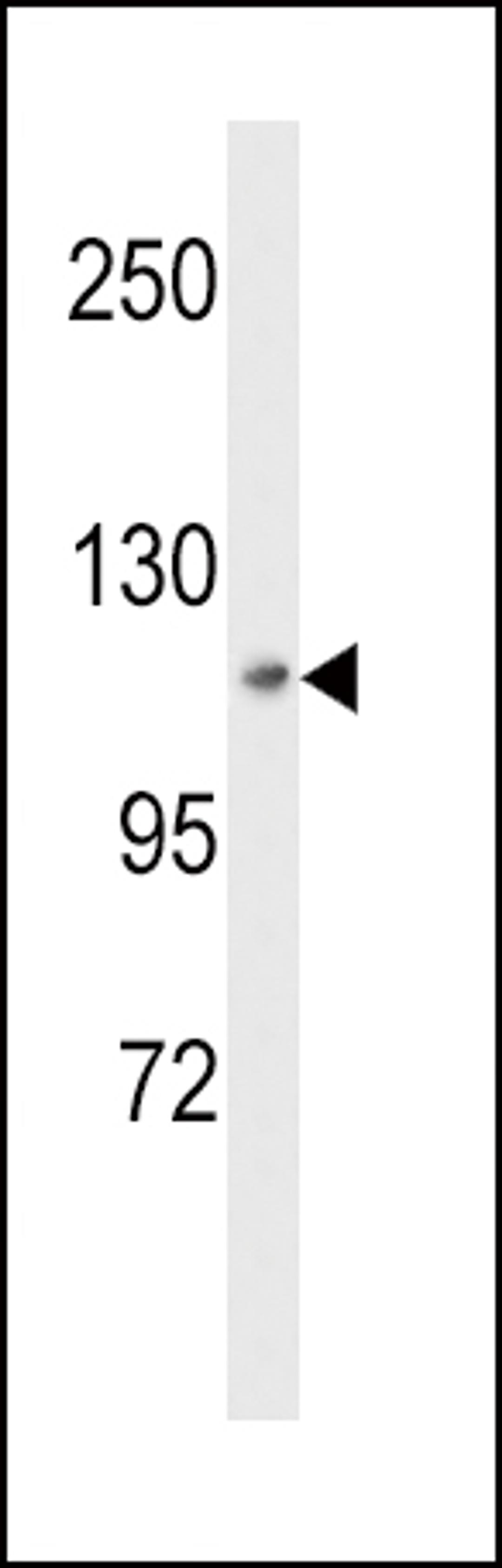 Western blot analysis of MAP4K3 Antibody in HepG2 cell line lysates (35ug/lane)