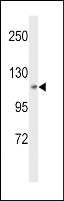 Western blot analysis of MAP4K3 Antibody in HepG2 cell line lysates (35ug/lane)