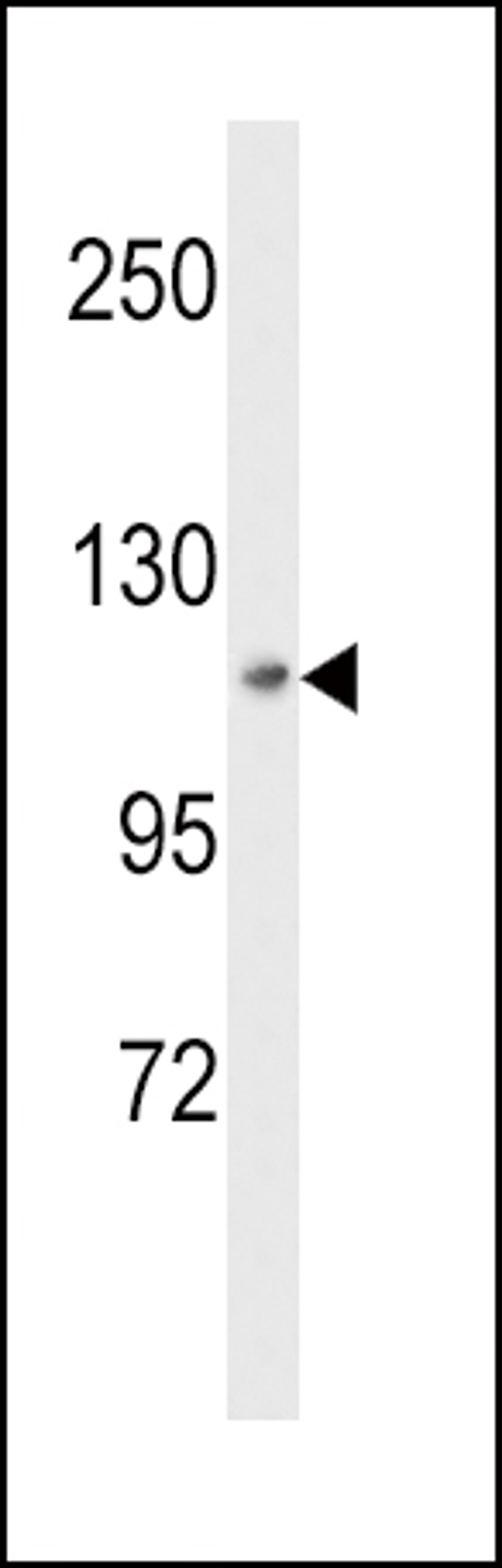 Western blot analysis of MAP4K3 Antibody in HepG2 cell line lysates (35ug/lane)