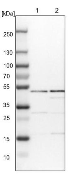 Western Blot: IPPK Antibody [NBP1-86712] - Lane 1: NIH-3T3 cell lysate (Mouse embryonic fibroblast cells)<br/>Lane 2: NBT-II cell lysate (Rat Wistar bladder tumour cells)