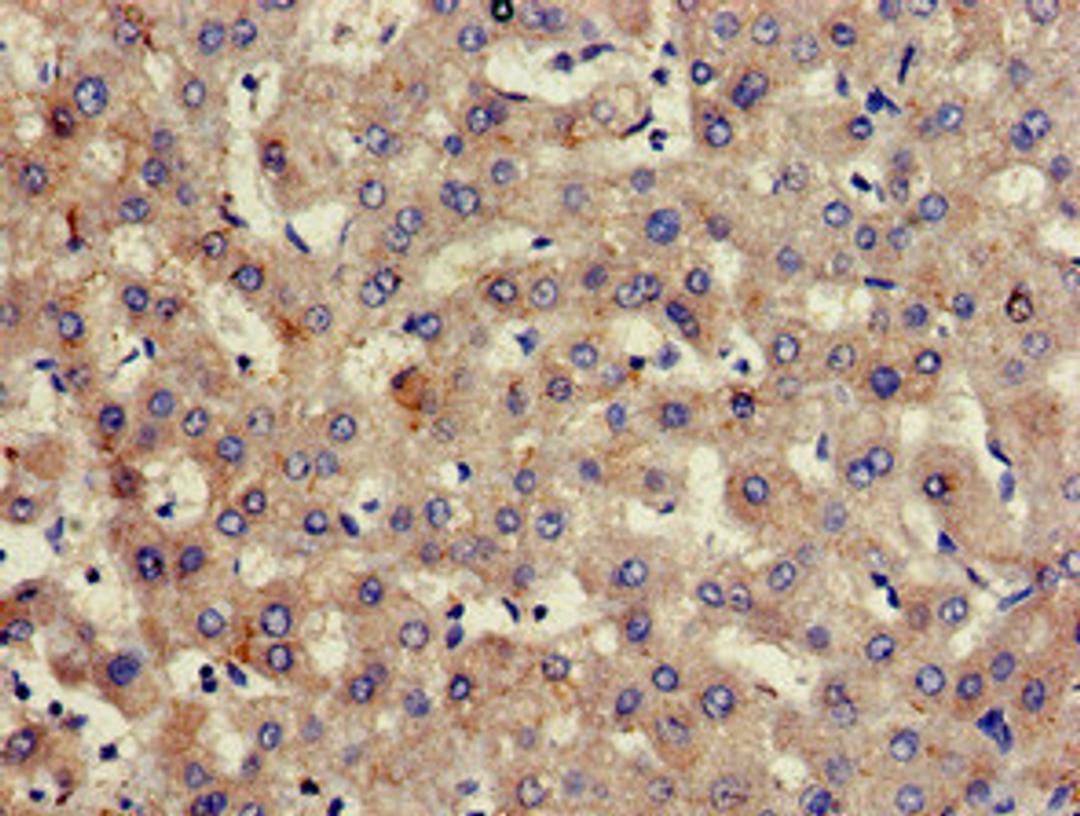 Immunohistochemistry of paraffin-embedded human liver tissue using CSB-PA14619A0Rb at dilution of 1:100