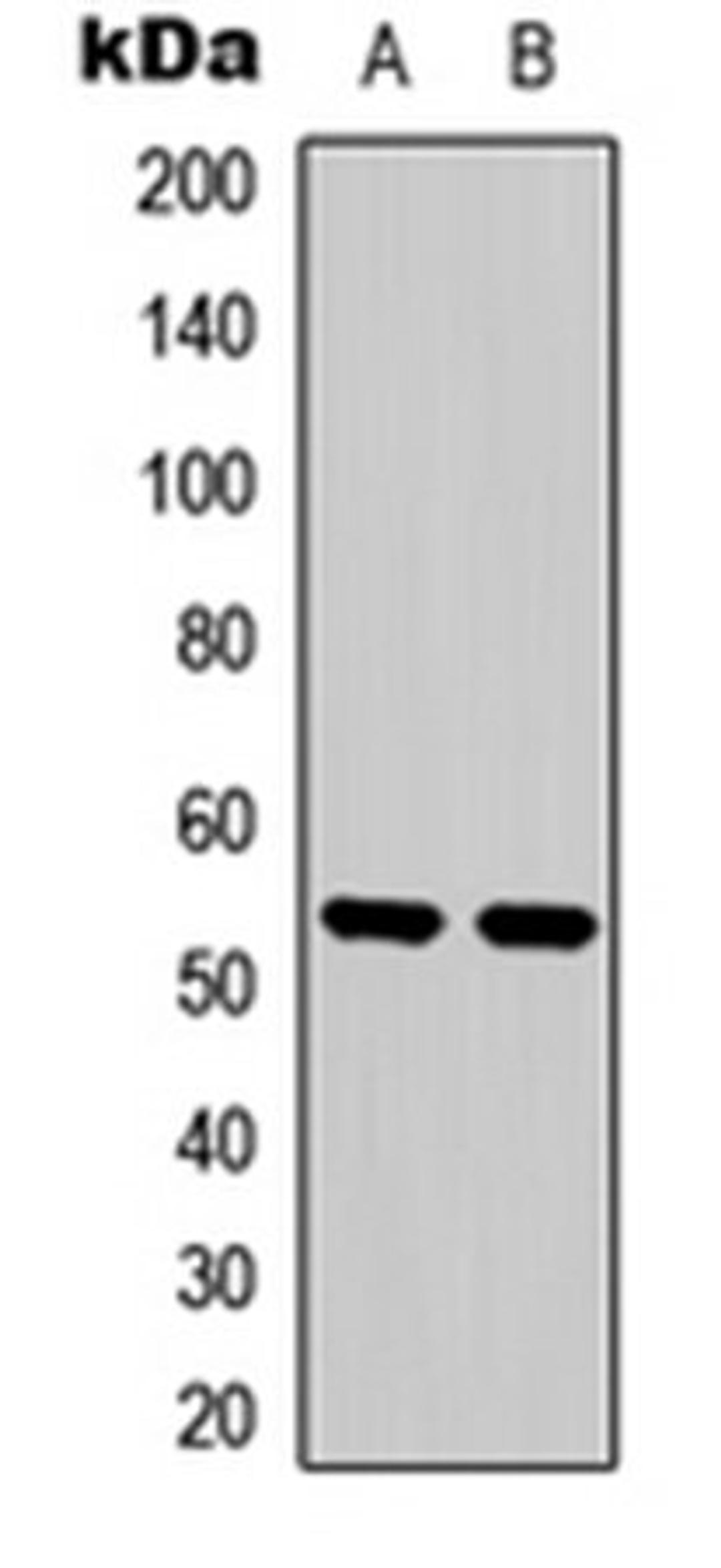 Western blot analysis of HeLa Calyculin A-treated (Lane 1), MCF7 (Lane 2) whole cell lysates using PTEN (pS370) antibody