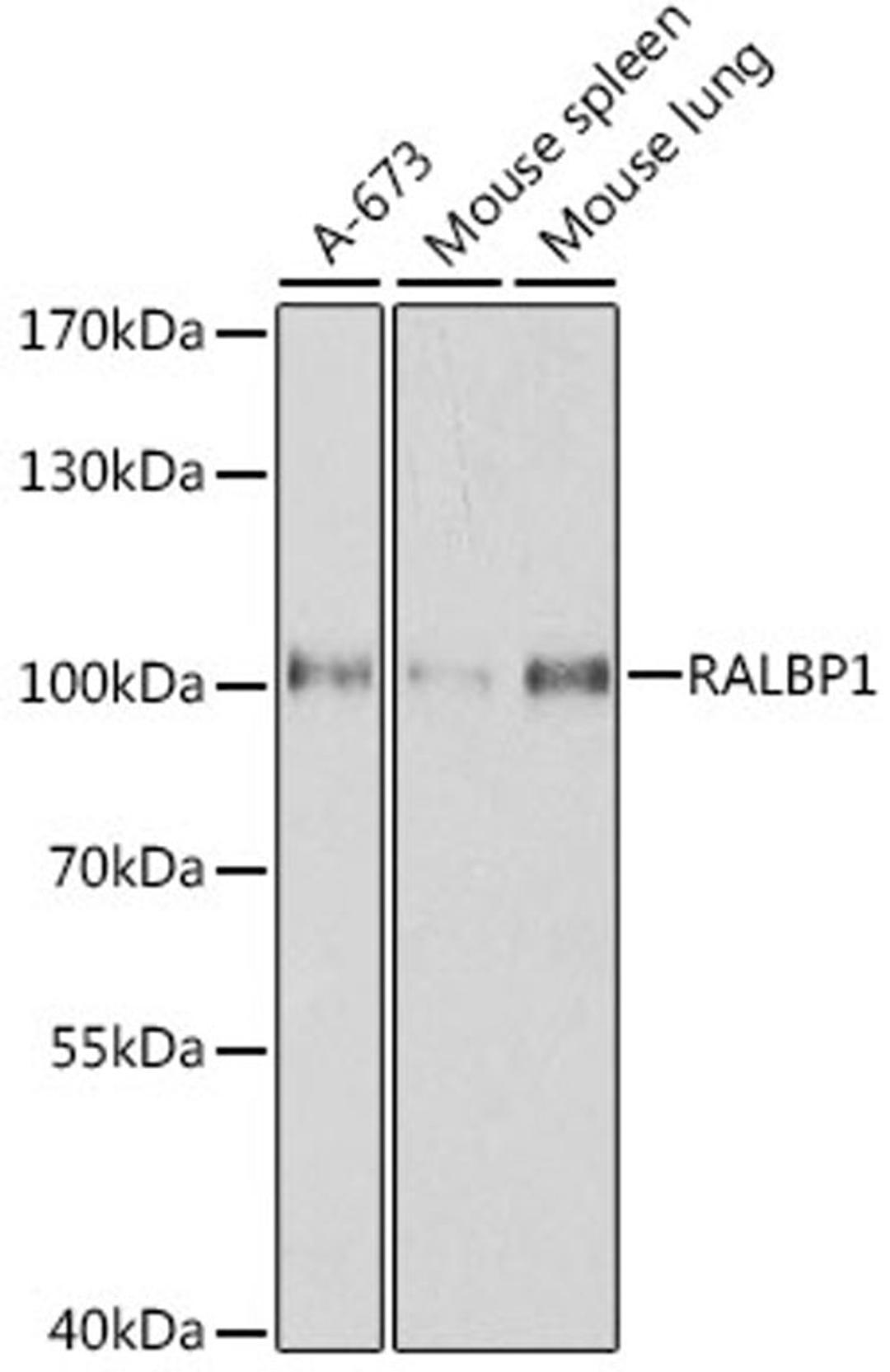 Western blot - RALBP1 antibody (A1140)