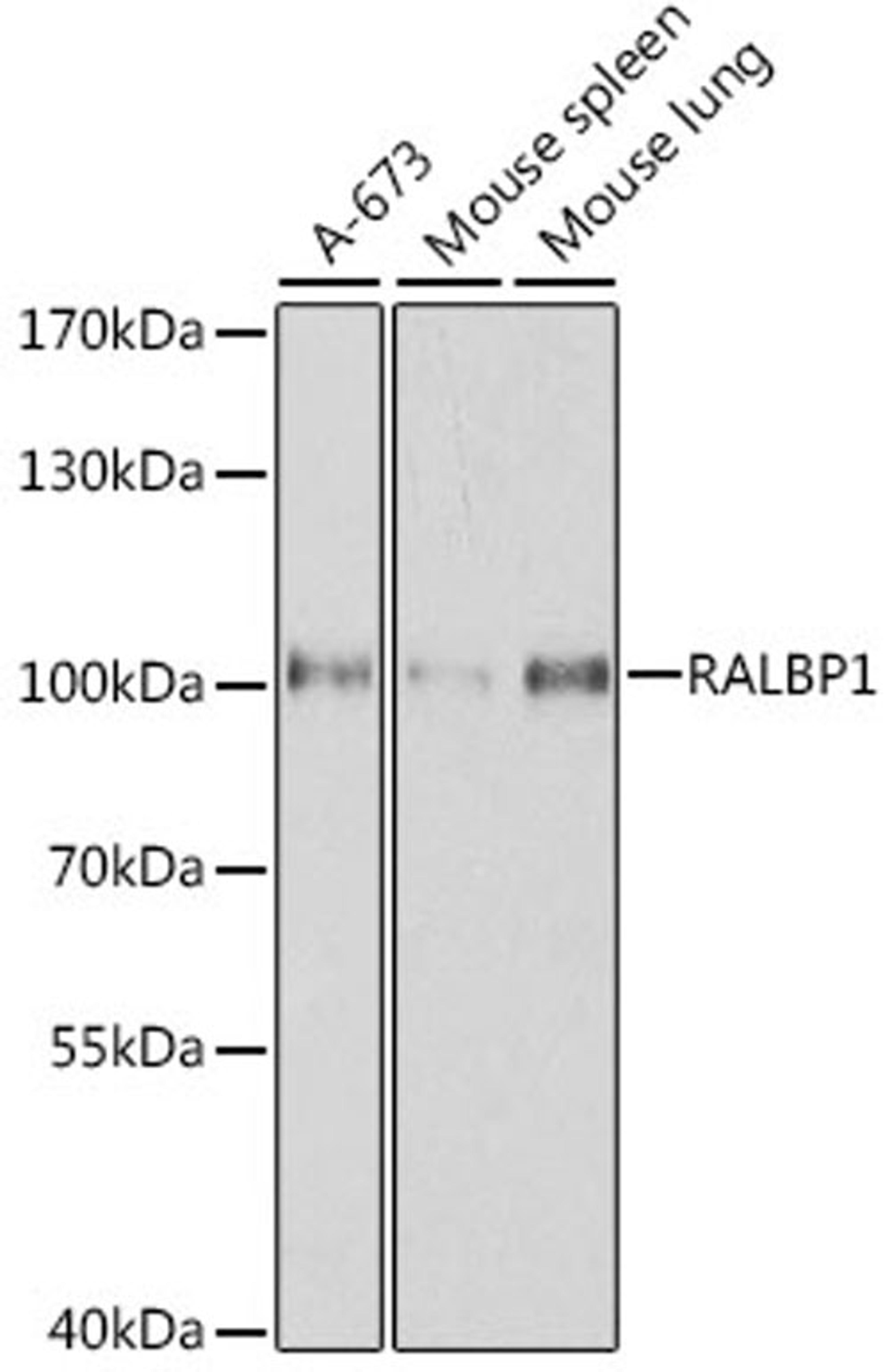 Western blot - RALBP1 antibody (A1140)