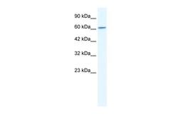 Antibody used in WB on Human HepG2 at 2.5 ug/ml.