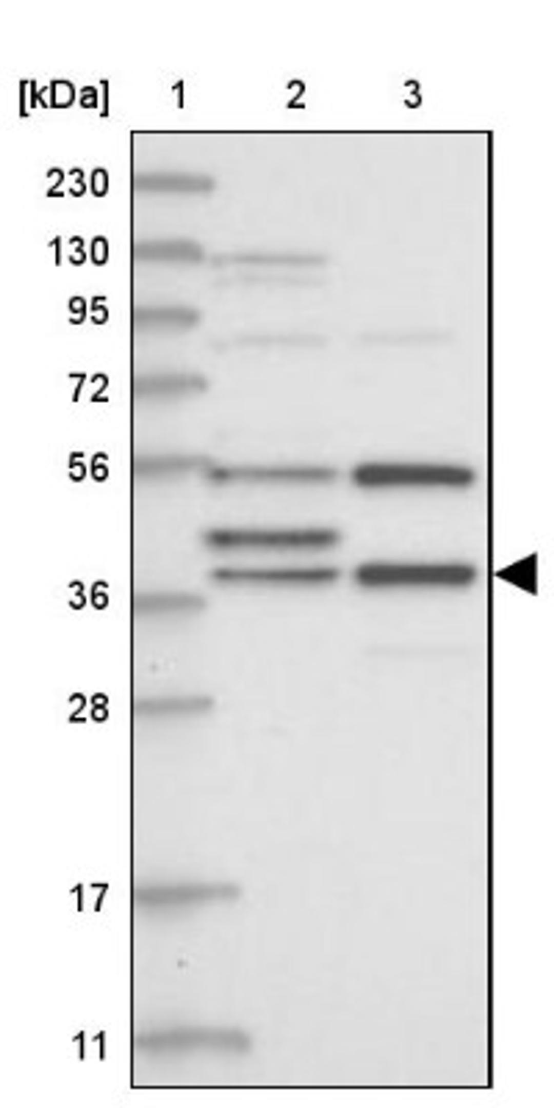 Western Blot: ZCWPW2 Antibody [NBP1-80606] - Lane 1: Marker [kDa] 230, 130, 95, 72, 56, 36, 28, 17, 11<br/>Lane 2: Human cell line RT-4<br/>Lane 3: Human cell line U-251MG sp