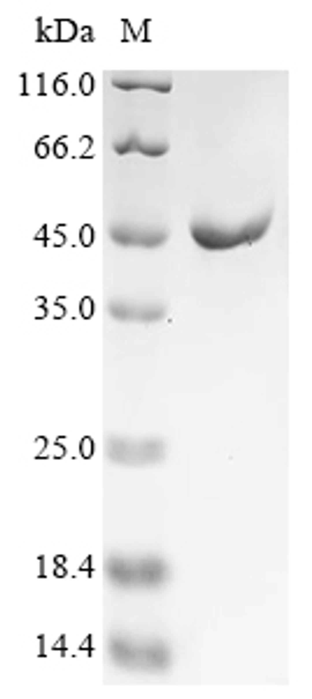 (Tris-Glycine gel) Discontinuous SDS-PAGE (reduced) with 5% enrichment gel and 15% separation gel.