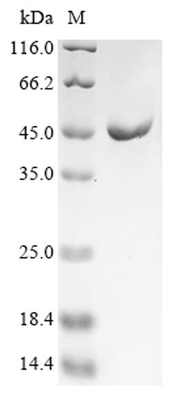 (Tris-Glycine gel) Discontinuous SDS-PAGE (reduced) with 5% enrichment gel and 15% separation gel.