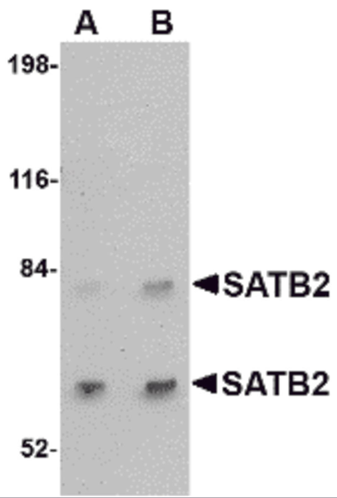 Western blot analysis of SATB2 in A20 cell lysate with SATB2 antibody at (A) 2 and (B) 4 μg/mL.
