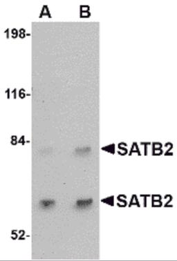 Western blot analysis of SATB2 in A20 cell lysate with SATB2 antibody at (A) 2 and (B) 4 μg/mL.