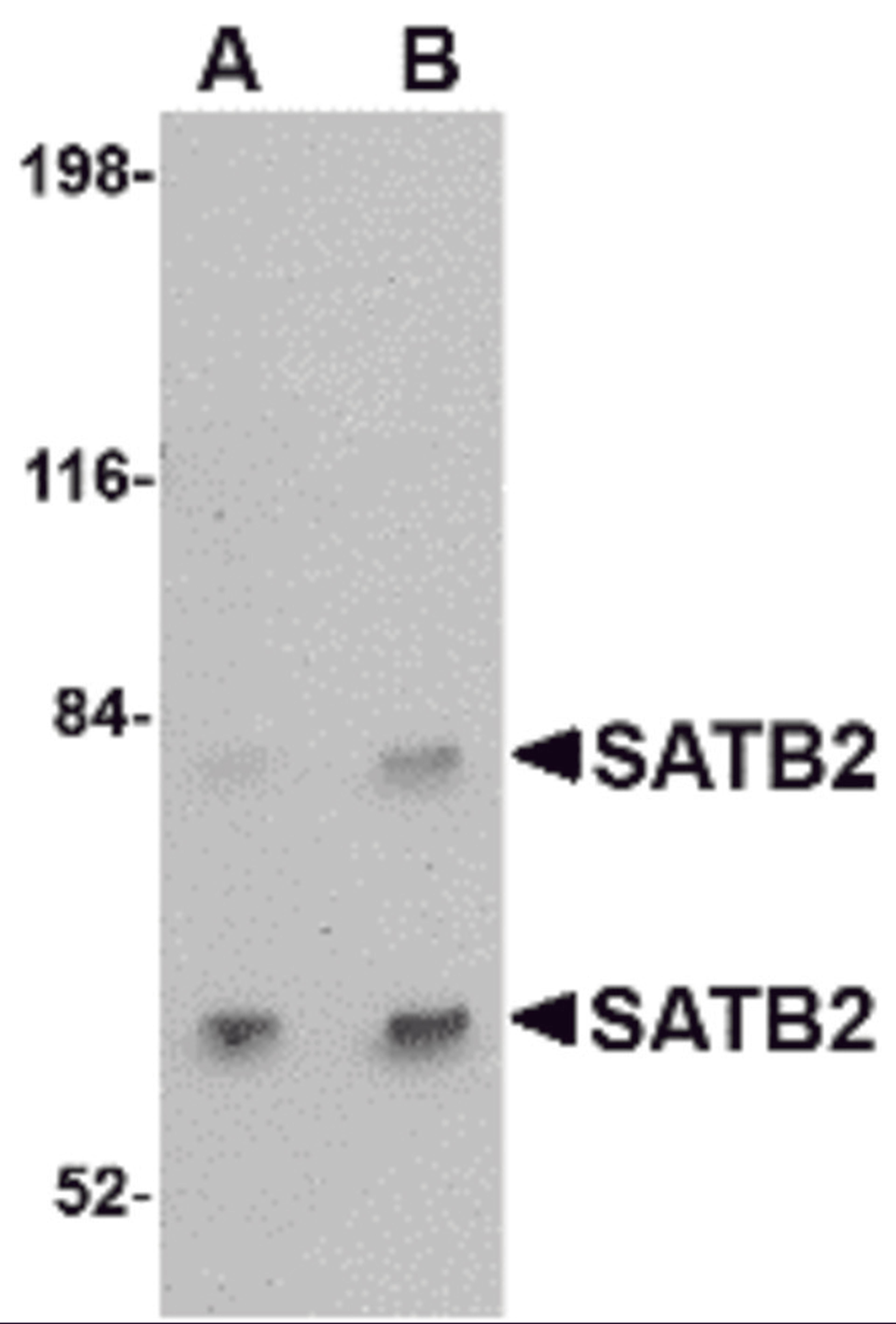 Western blot analysis of SATB2 in A20 cell lysate with SATB2 antibody at (A) 2 and (B) 4 μg/mL.