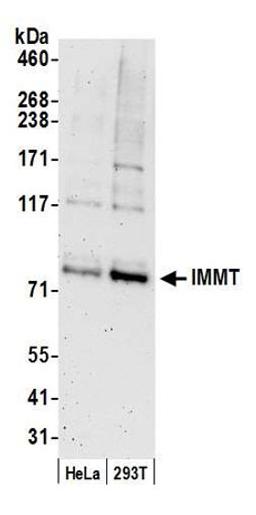 Detection of human IMMT by western blot.