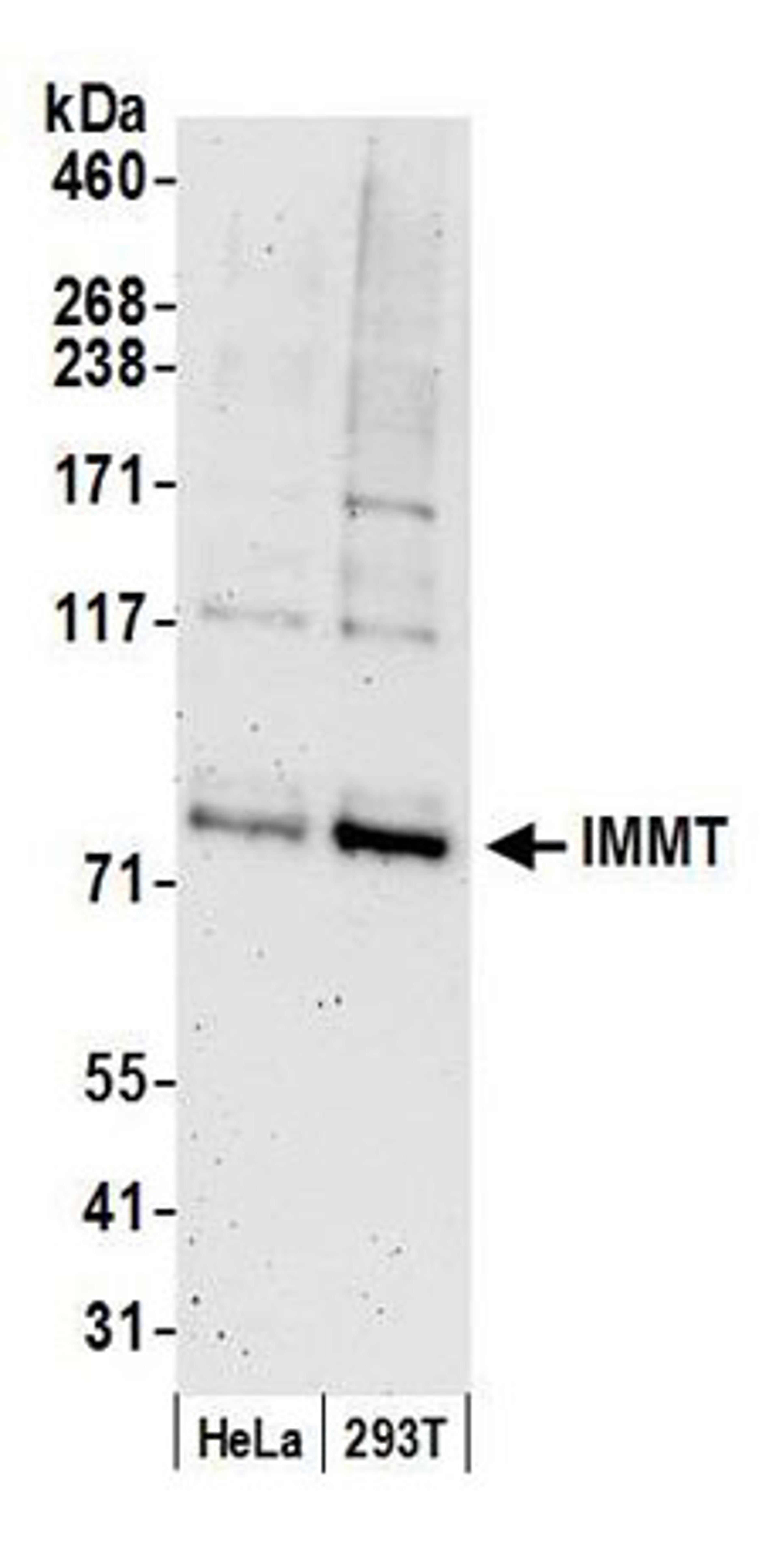 Detection of human IMMT by western blot.