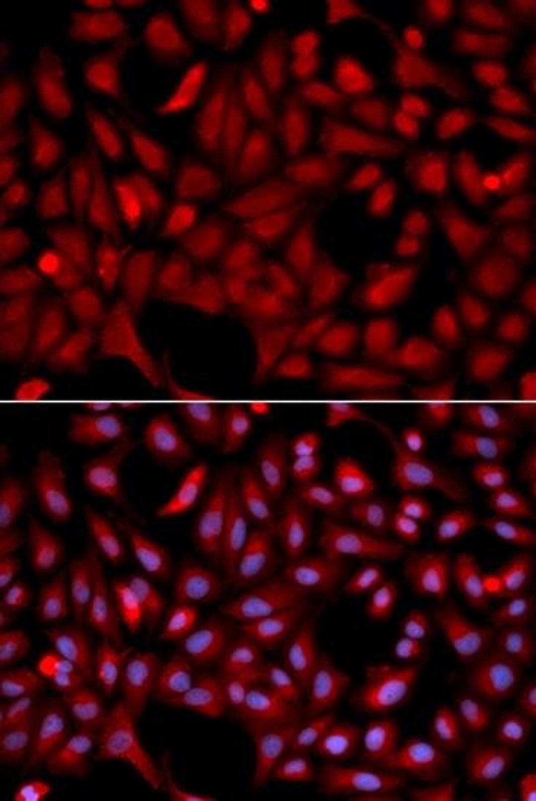 Immunofluorescense analysis of U2OS cell using SIAH1 antibody