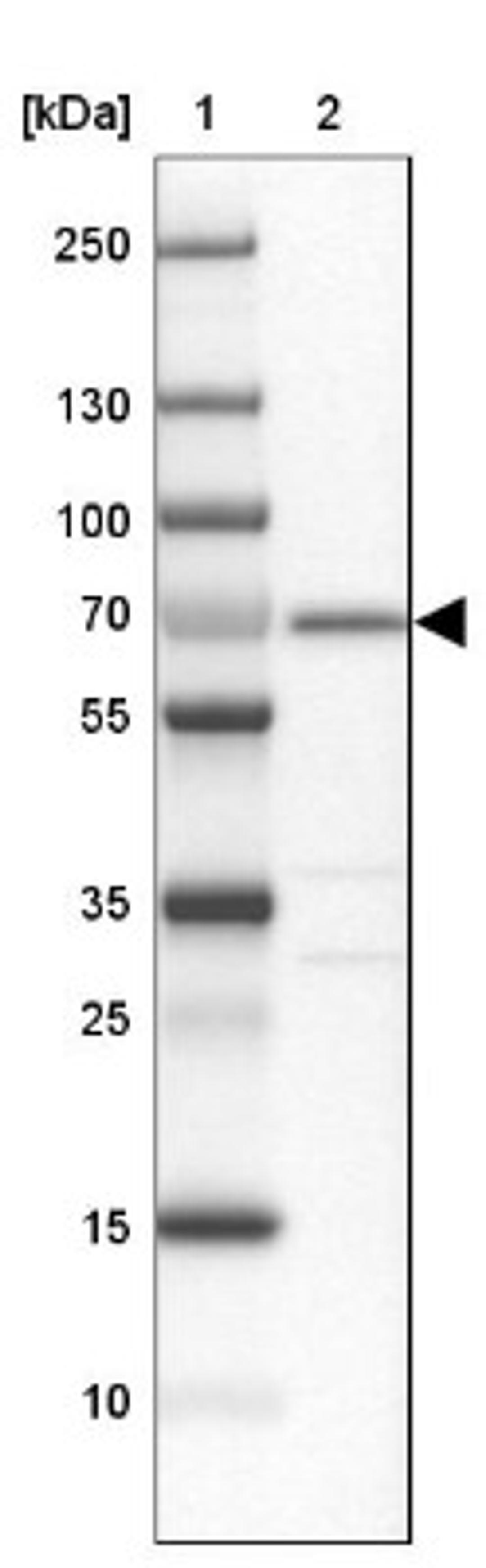 Western Blot: DMPK Antibody [NBP1-85010] - Lane 1: Marker [kDa] 250, 130, 100, 70, 55, 35, 25, 15, 10<br/>Lane 2: A-549