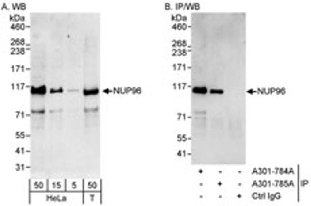 Detection of human NUP96 by western blot and immunoprecipitation.