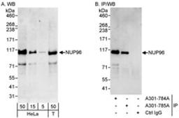 Detection of human NUP96 by western blot and immunoprecipitation.