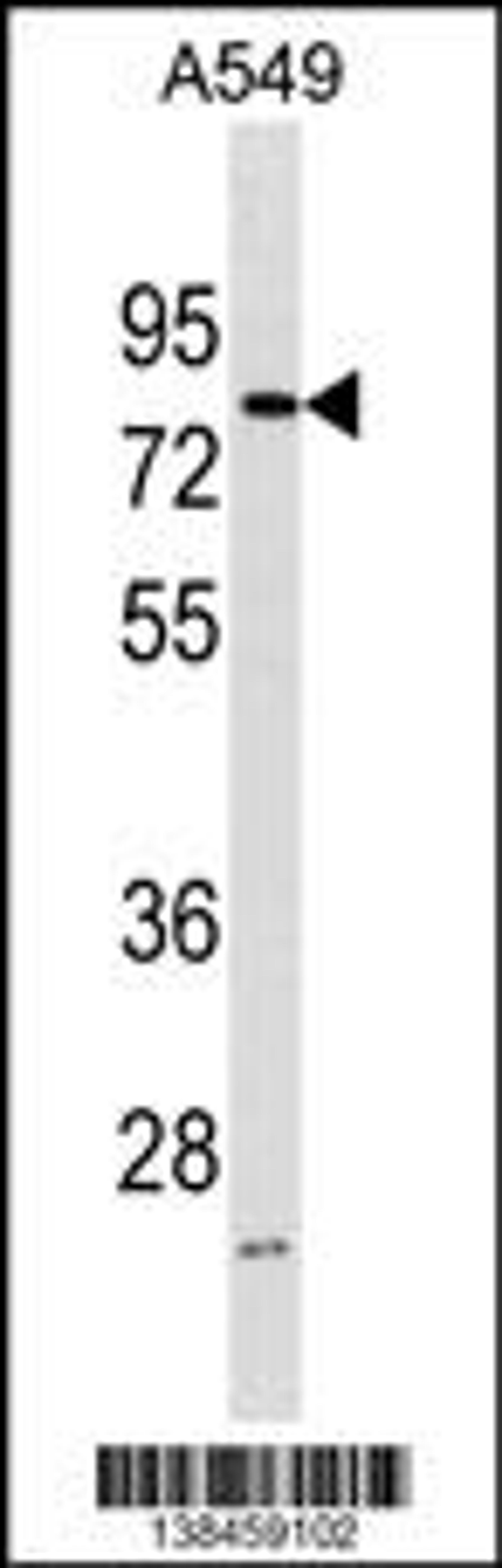 Western blot analysis in A549 cell line lysates (35ug/lane).