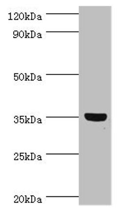 Western blot. All lanes: GLYATL1 antibody at 8ug/ml + Rat liver tissue. Secondary. Goat polyclonal to rabbit IgG at 1/10000 dilution. Predicted band size: 36, 39 kDa. Observed band size: 36 kDa.
