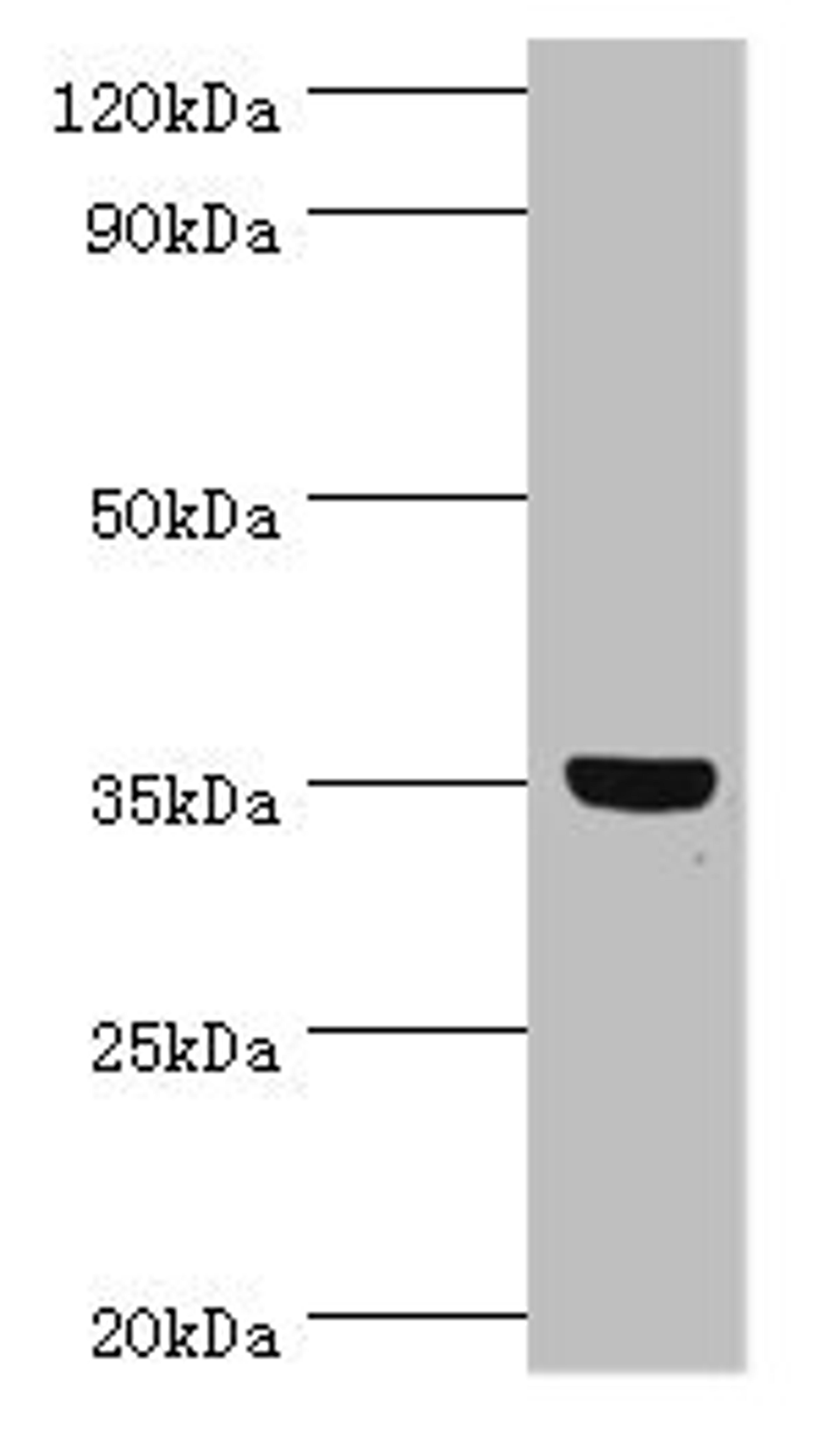 Western blot. All lanes: GLYATL1 antibody at 8ug/ml + Rat liver tissue. Secondary. Goat polyclonal to rabbit IgG at 1/10000 dilution. Predicted band size: 36, 39 kDa. Observed band size: 36 kDa.