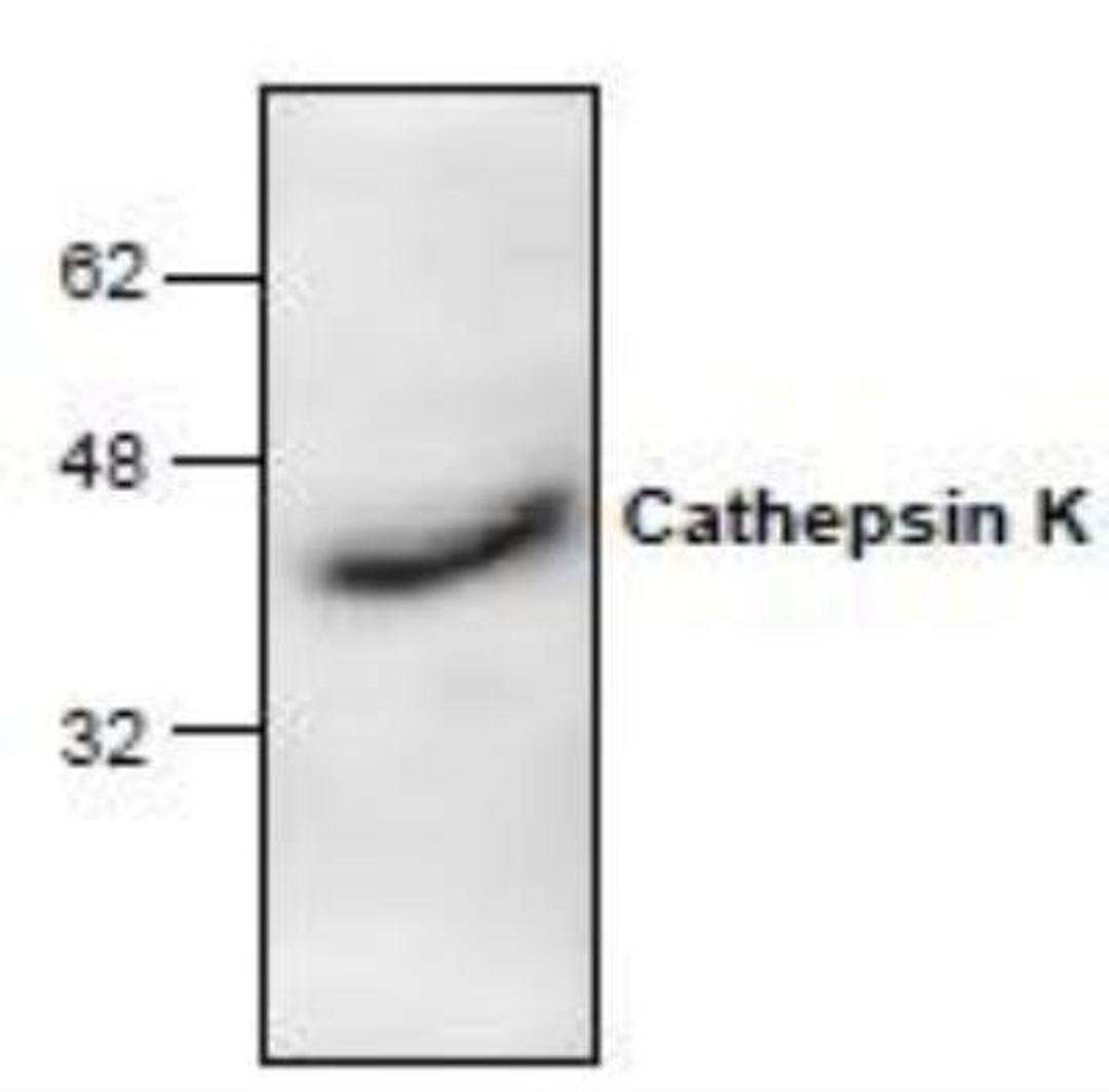 Western Blot: Cathepsin K Antibody [NBP1-45460] - Western blot analysis of Cathepsin K with rat  kidney tissue lysate.