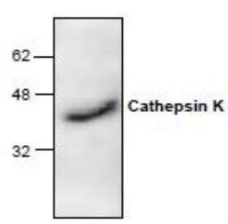 Western Blot: Cathepsin K Antibody [NBP1-45460] - Western blot analysis of Cathepsin K with rat  kidney tissue lysate.