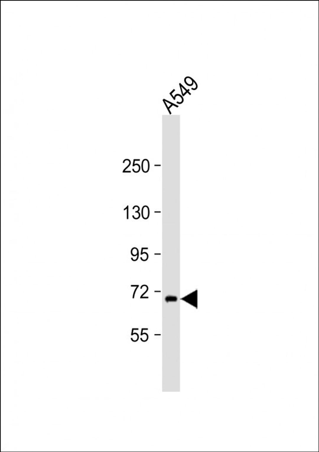 Western Blot at 1:2000 dilution + A549 whole cell lysate Lysates/proteins at 20 ug per lane.