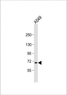 Western Blot at 1:2000 dilution + A549 whole cell lysate Lysates/proteins at 20 ug per lane.