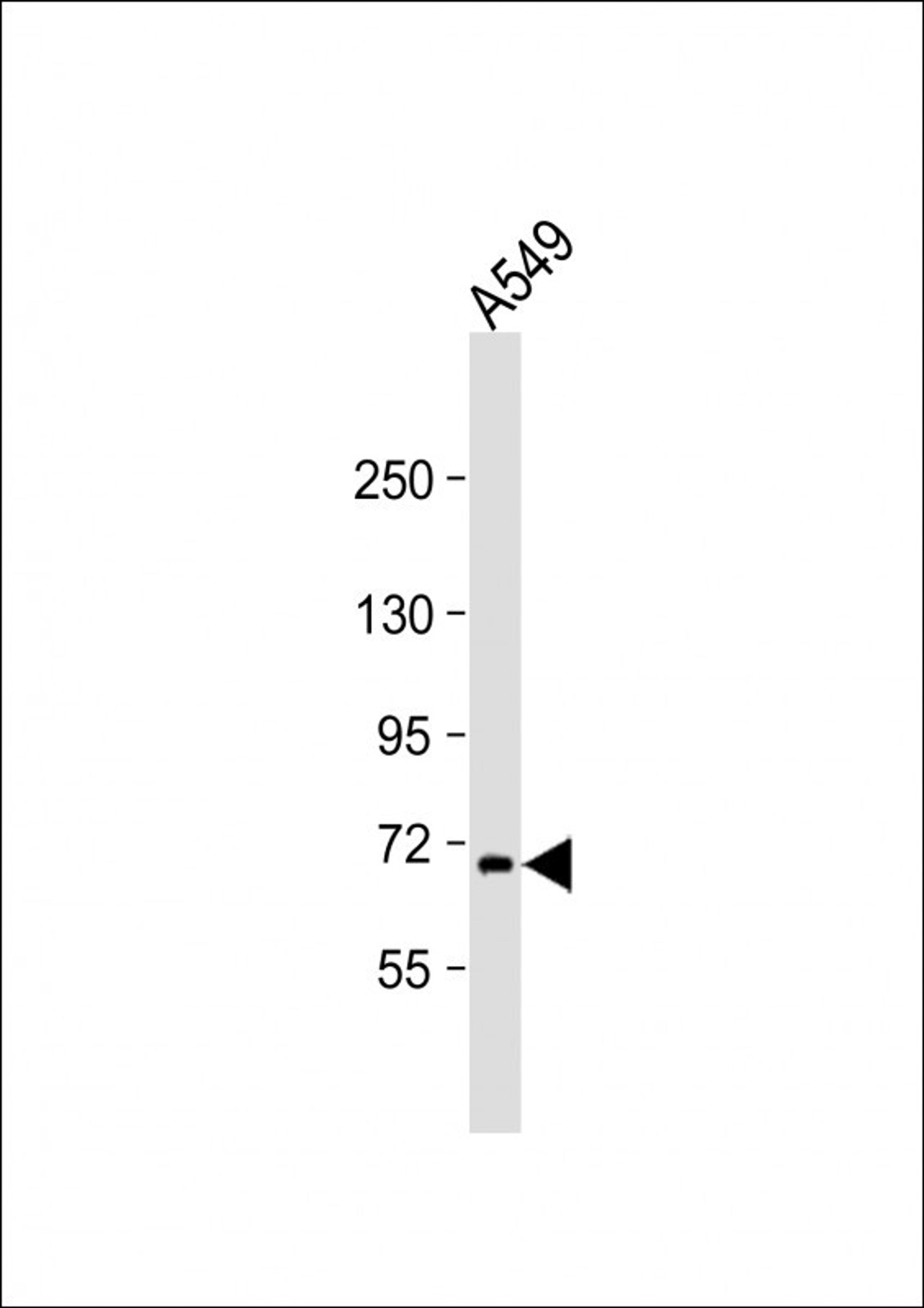 Western Blot at 1:2000 dilution + A549 whole cell lysate Lysates/proteins at 20 ug per lane.