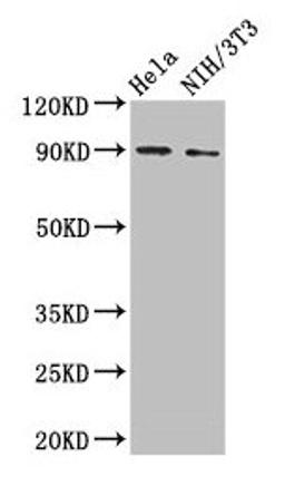 Western Blot. Positive WB detected in: Hela whole cell lysate, NIH/3T3 whole cell lysate. All lanes: L1CAM antibody at 2µg/ml. Secondary. Goat polyclonal to rabbit IgG at 1/50000 dilution. Predicted band size: 141, 140, 139 kDa. Observed band size: 90 kDa