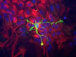 Immunocytochemistry/Immunofluorescence: Coronin-1a Antibody [NB110-58867] - Immunocytochemistry of a mixed neuron/glial culture from newborn rat brain stained with NB110-58867 (green) at a dilution of 1:10,000 and NB300-223 (our antibody to vimentin made in chicken at 1:5,000). Blue is nuclear DNA counter stain. Glial cells and fibroblasts stain with vimentin, while microglia alone stain strongly and specifically for Coronin-1a, which can therefore be used as a robust marker of this important cell type.