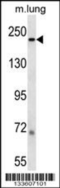 Western blot analysis in mouse lung tissue lysates (35ug/lane).