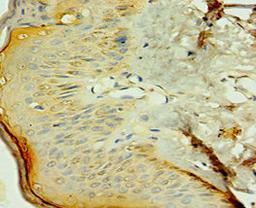 Immunohistochemistry of paraffin-embedded human skin tissue using CSB-PA016052ESR1HU at dilution of 1:100